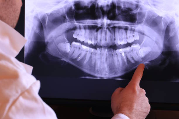 Best Emergency Care for Gum Disease in Beech Grove, IN