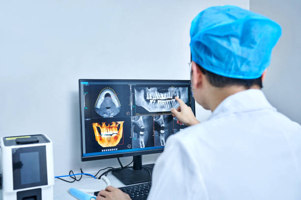 Best Emergency Wisdom Tooth Extraction in Beech Grove, IN
